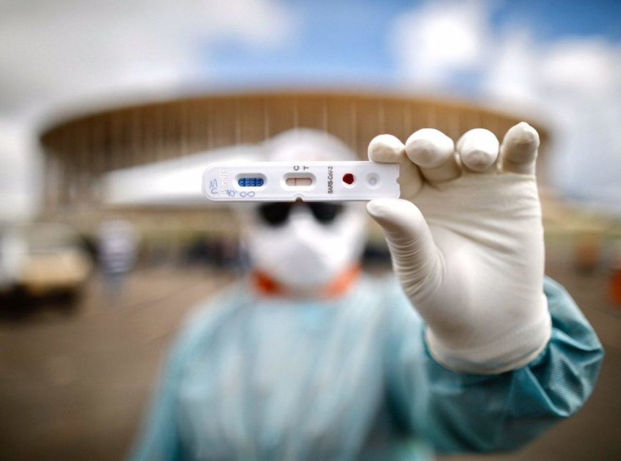 APARECIDA: Secretaria de saúde fará testes de Covid-19 nos profissionais que estão na linha de frente do combate ao coronavírus. 08062020 teste covid 19 Easy Resize.com - APARECIDA: Secretaria de saúde fará testes de Covid-19 nos profissionais que estão na linha de frente do combate ao coronavírus.