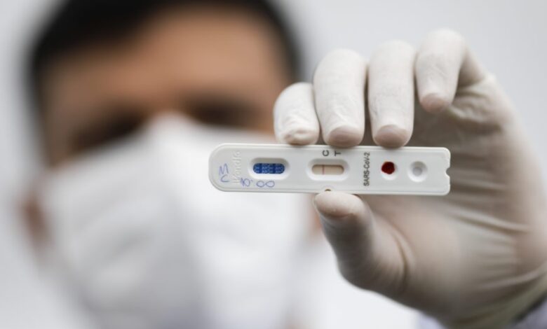 PARTINDO NA FRENTE: Município de Tenente Ananias implanta testagem rápida em todos os trabalhadores dos serviços essenciais do comércio local para conter avanço da pandemia testagem 780x470 - PARTINDO NA FRENTE: Município de Tenente Ananias implanta testagem rápida em todos os trabalhadores dos serviços essenciais do comércio local para conter avanço da pandemia