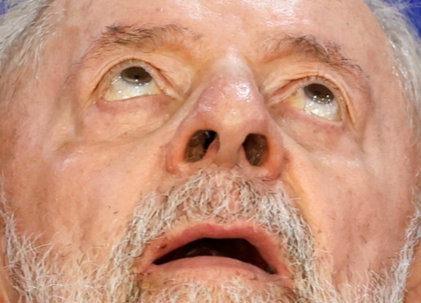 Médico de Lula diz que presidente teve pequena hemorragia cerebral em queda lula - Médico de Lula diz que presidente teve pequena hemorragia cerebral em queda